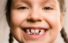 儿童牙齿正畸后要如何护理