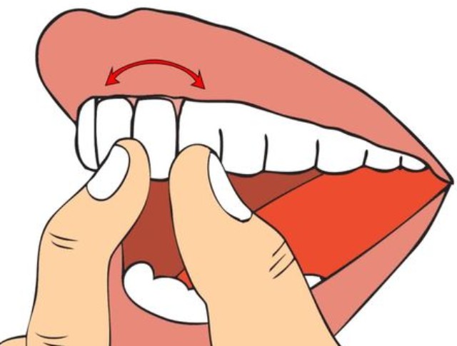 牙齿松动的原因有哪些？还有救吗？