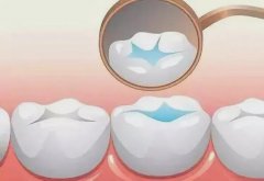 保护&ldquo;六龄齿&rdquo; 谨记这三招